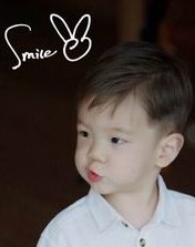 苏州市立医院试管婴儿取-卵打麻醉吗？你了解打麻醉这件事情吗？