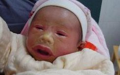 成都的正规试管婴儿医院收费标准是怎么样的？如何保证试管成功率？