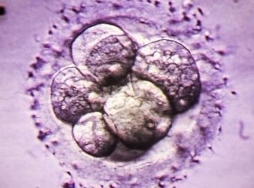 驻马店中心医院生殖中心 告诉你如何判断患者是否适合试管婴儿？